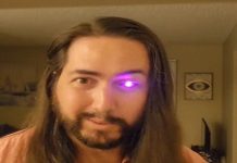 El famoso “Hombre Nuclear” comienza a ser realidad: Ojo biónico reemplaza a uno dañado por el cáncer